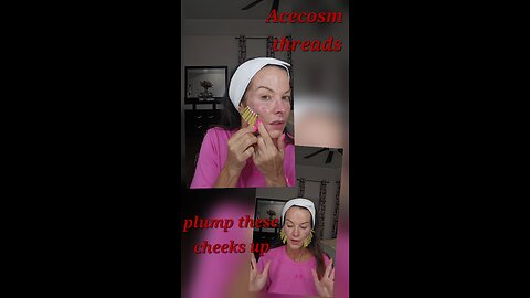 Acecosm Threads. AestheLine Screw PDO. Plump Cheeks