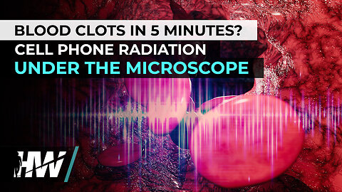 BLOOD CLOTS IN 5 MINUTES❓ CELL PHONE RADIATION UNDER THE MICROSCOPE