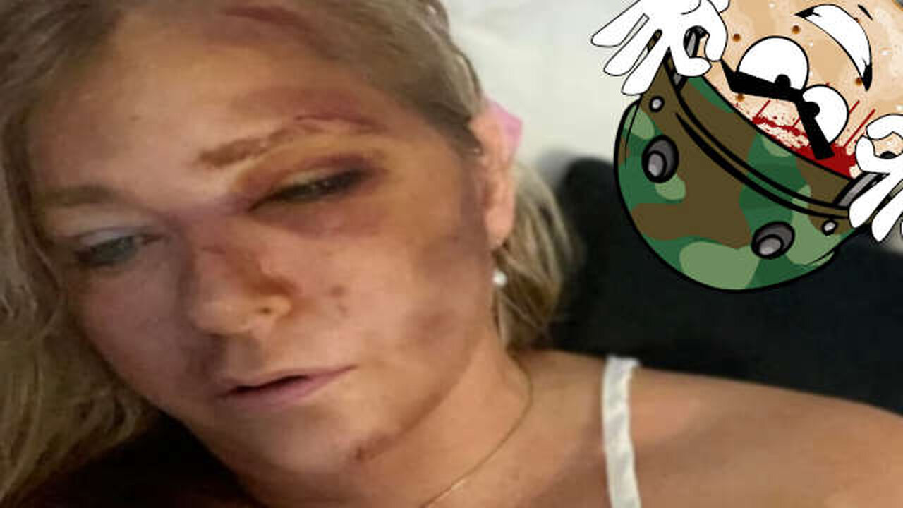 Epstein Accuser Hit By Bus SaltCast 03-31-25