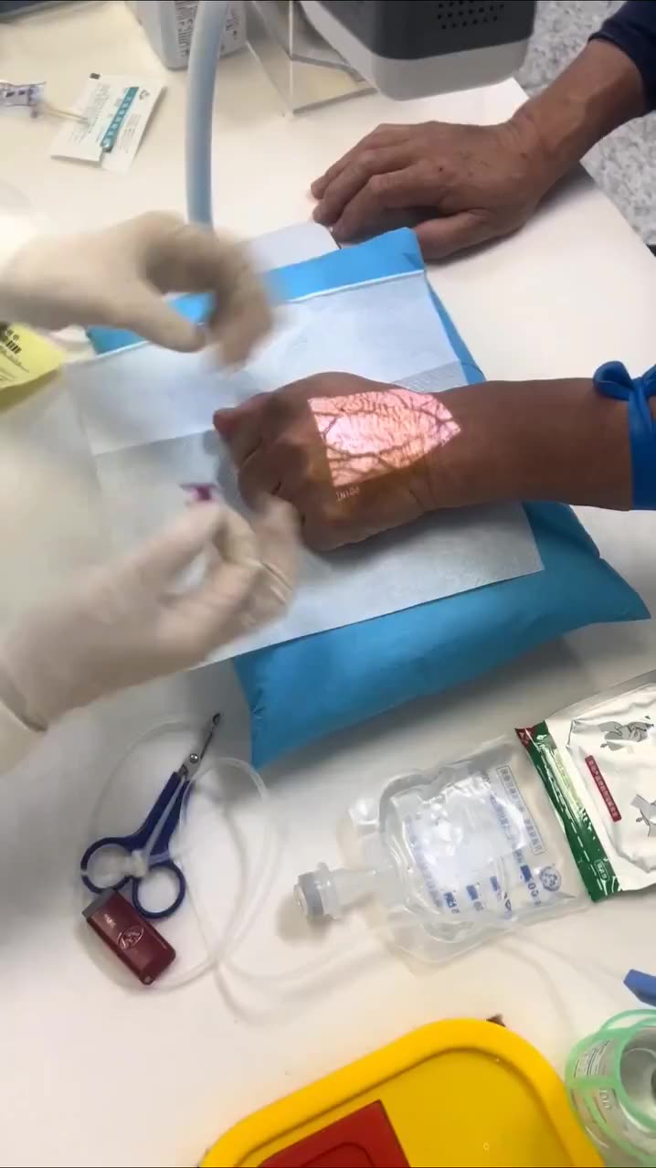 VEIN VIEWERS USE NEAR-INFRARED LIGHT WHICH IS ABSORBED BY VEINS & REFLECTED BY SURROUNDING TISSUES