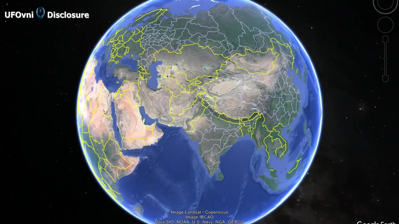 Une immense lumière, cloques sur tout le bas du corps, Yusui, préfecture de Kagoshima, Japon