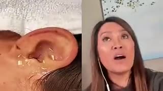 Live Insect In Ear Dr Pimple Popper Reacts