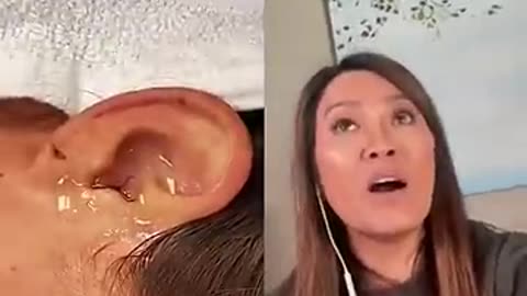 Live Insect In Ear Dr Pimple Popper Reacts