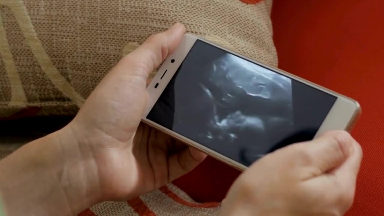 Journey to Parenthood: IVF Step-by-Step at Sumathi Hospital