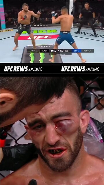 No defense, no dancing — just hands flying and bodies dropping. 🧨🥊