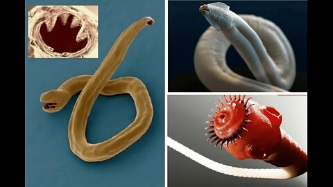 AMERICA NEEDS A COMPREHENSIVE PARASITE CLEANSE with Dr. Lee Merritt