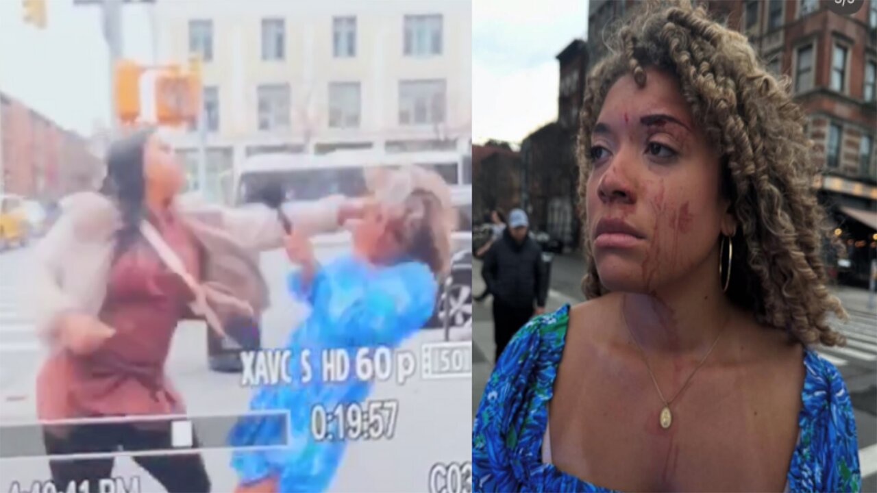 Conservative interviewer left BLOODIED after SHOCKING ATTACK by LEFTIST!