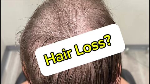 Hair loss?