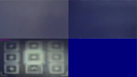 tesla brain implant robot