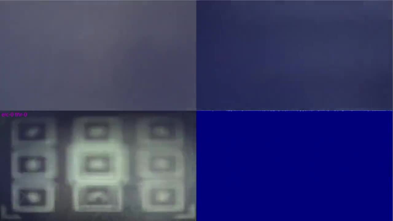 tesla brain implant robot