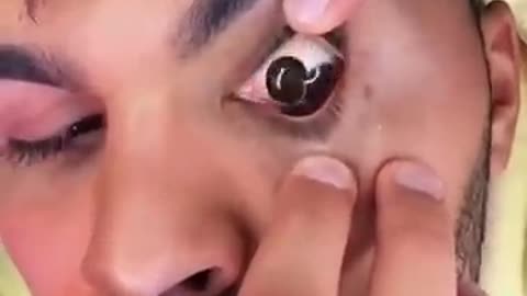 MY EYEBALL POPPED OUT
