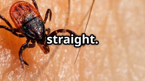 The How to Deal with Ticks #prepping #shtf #shtfsurvival