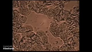 Hidden Truth About Cancer