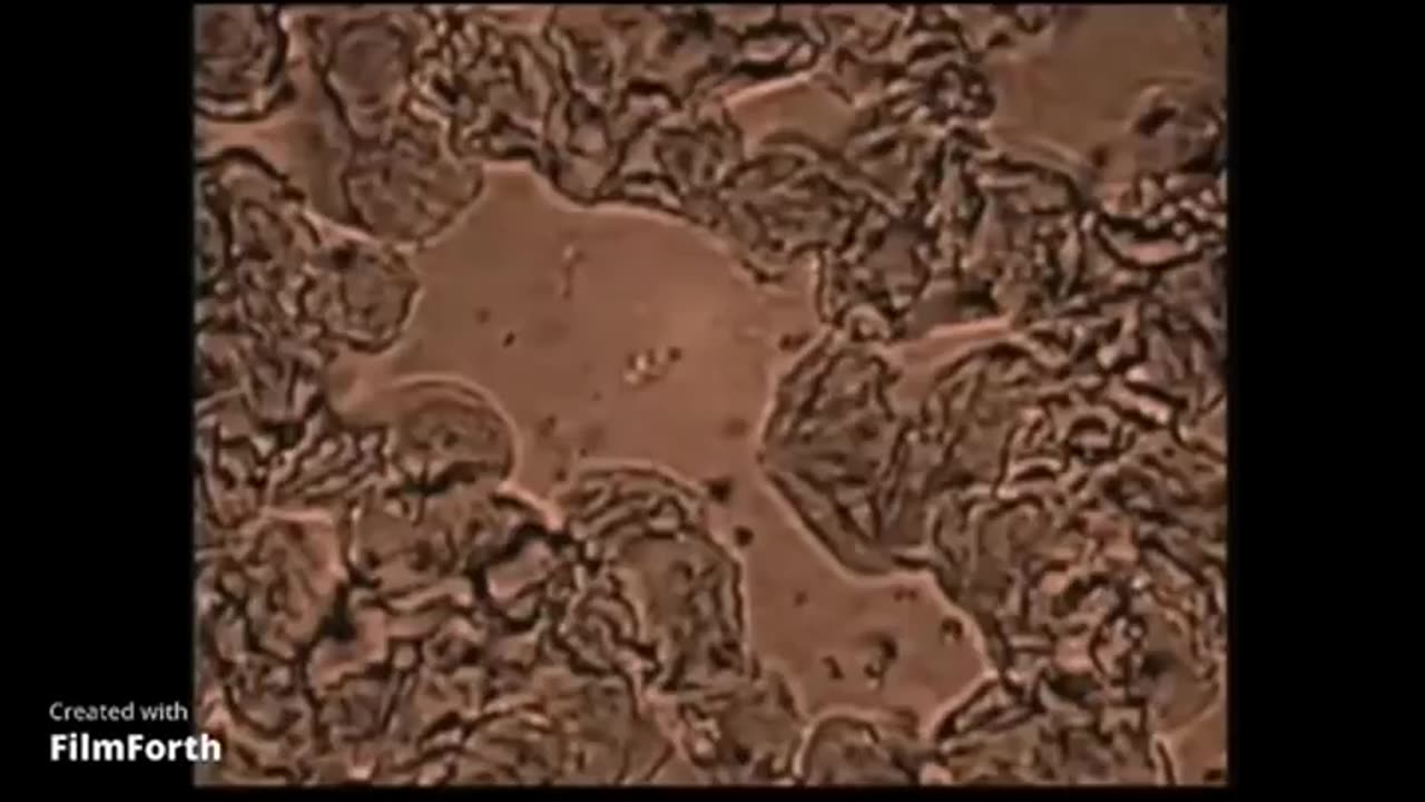 Hidden Truth About Cancer