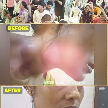 ANM Mumbai Church Testimony – Cancer पर विजय | यीशु ने दी अद्भुत चंगाई!