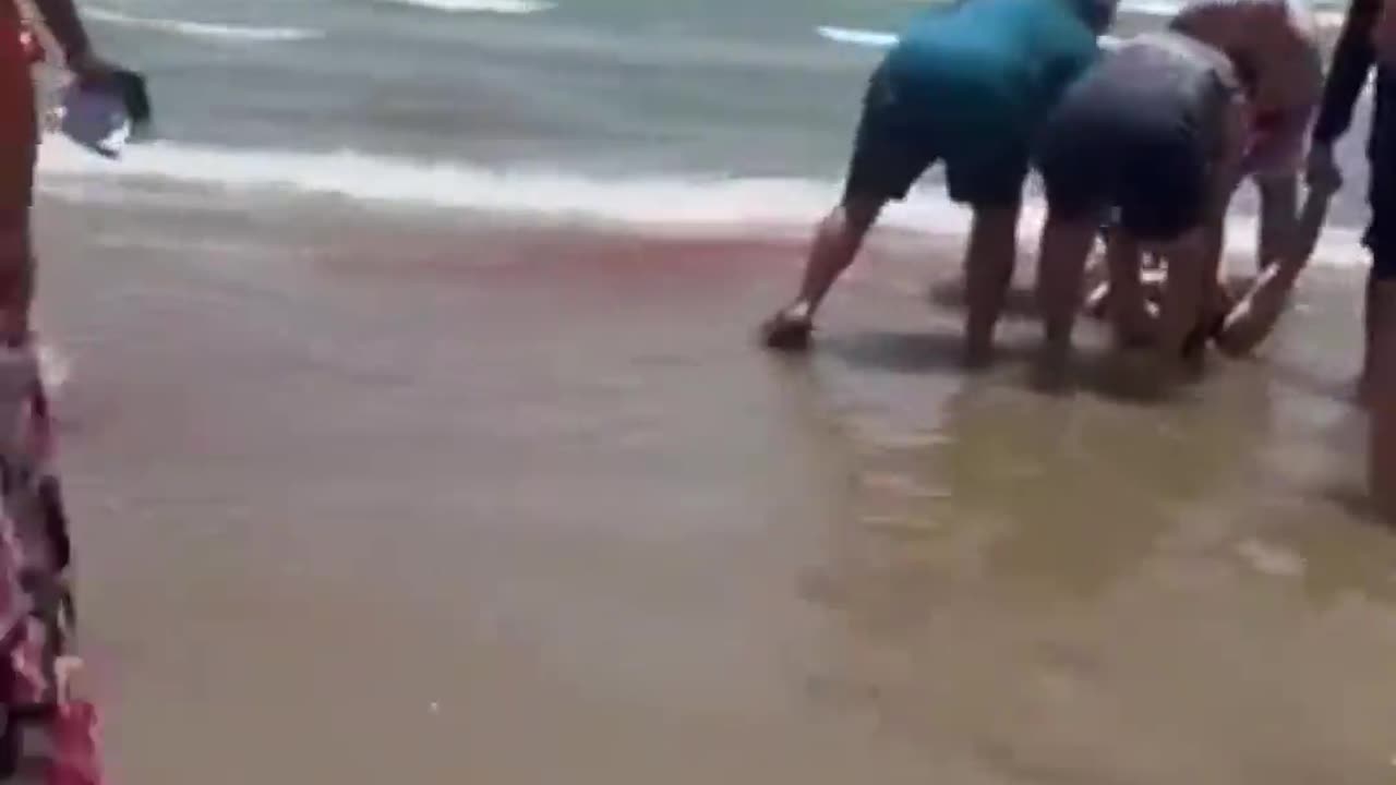 Woman Gets Bitten By A Shark In Texas On 4th Of July