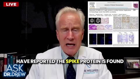 Covid-19 mRNA Shots Result in Brain Spike Protein Production Leading to Hemorrhagic Stroke