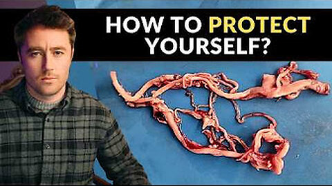 Clots found in every single person.