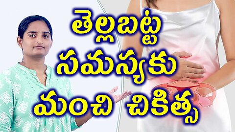 తెల్లబట్ట సమస్యకు మంచి చికిత్స Best Treatment Of White Discharge Homeopathy Treatment Medicine Cure