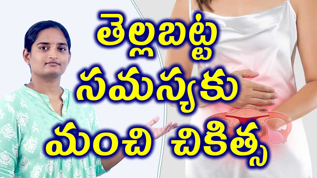తెల్లబట్ట సమస్యకు మంచి చికిత్స Best Treatment Of White Discharge Homeopathy Treatment Medicine Cure