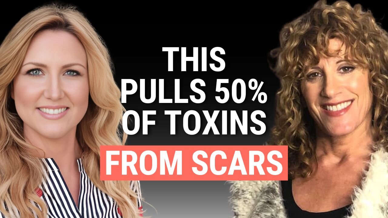 Detox Scars, Surgeries, and Dental Work With Mud Packing and Castor Oil | Julie EHealth