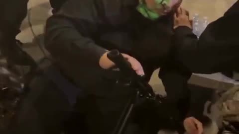 Close up video shows the aftermath of a protester that was shot in the face with a pepper ball