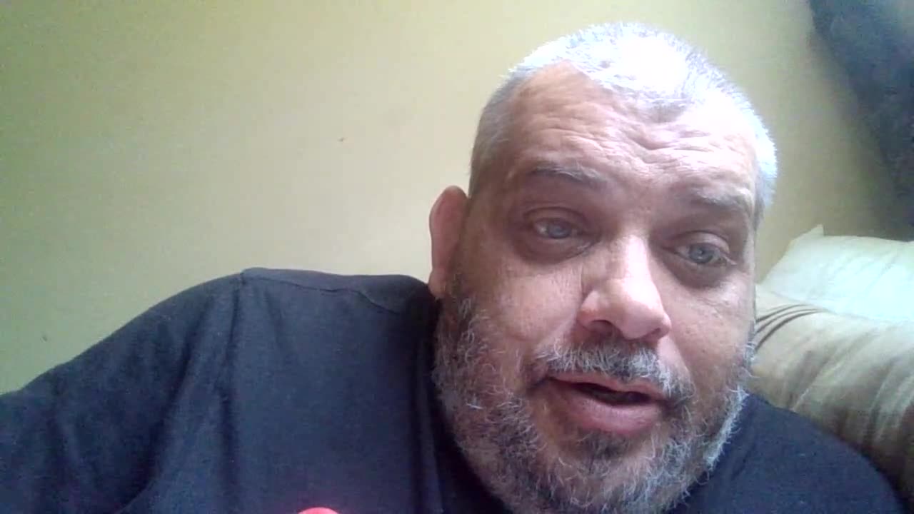 Elon Musks Black Eye