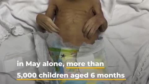 Famine in Gaza