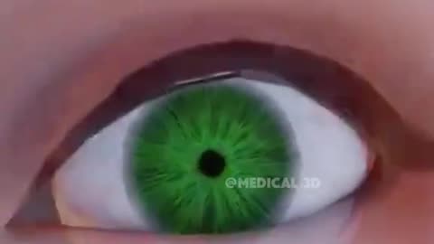 LASIK Eye Surgery (3D Animation)
