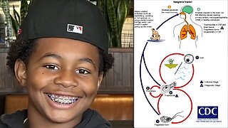 CHILD DIES FROM BRAIN-EATING AMOEBA: Family raises awareness but ignores mRNA Vaccines tied Risks