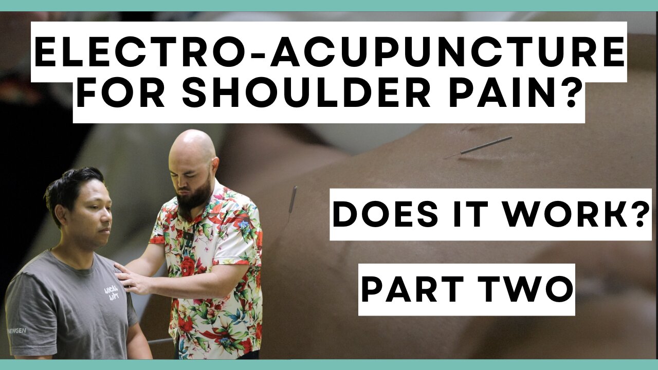 ELECTRO ACUPUNCTURE FOR SHOULDER PAIN?