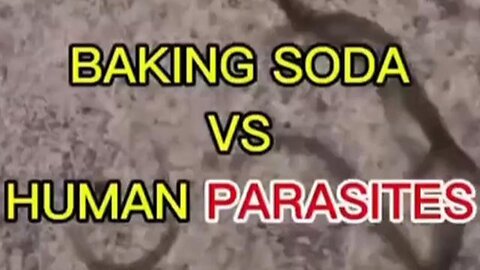 Baking Soda vs Human Parasites Known as Cancer (Under The Microscope)