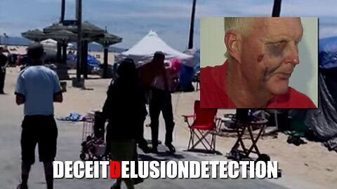 An elderly white male street performer was sucker-punched by a random black man in Venice Beach