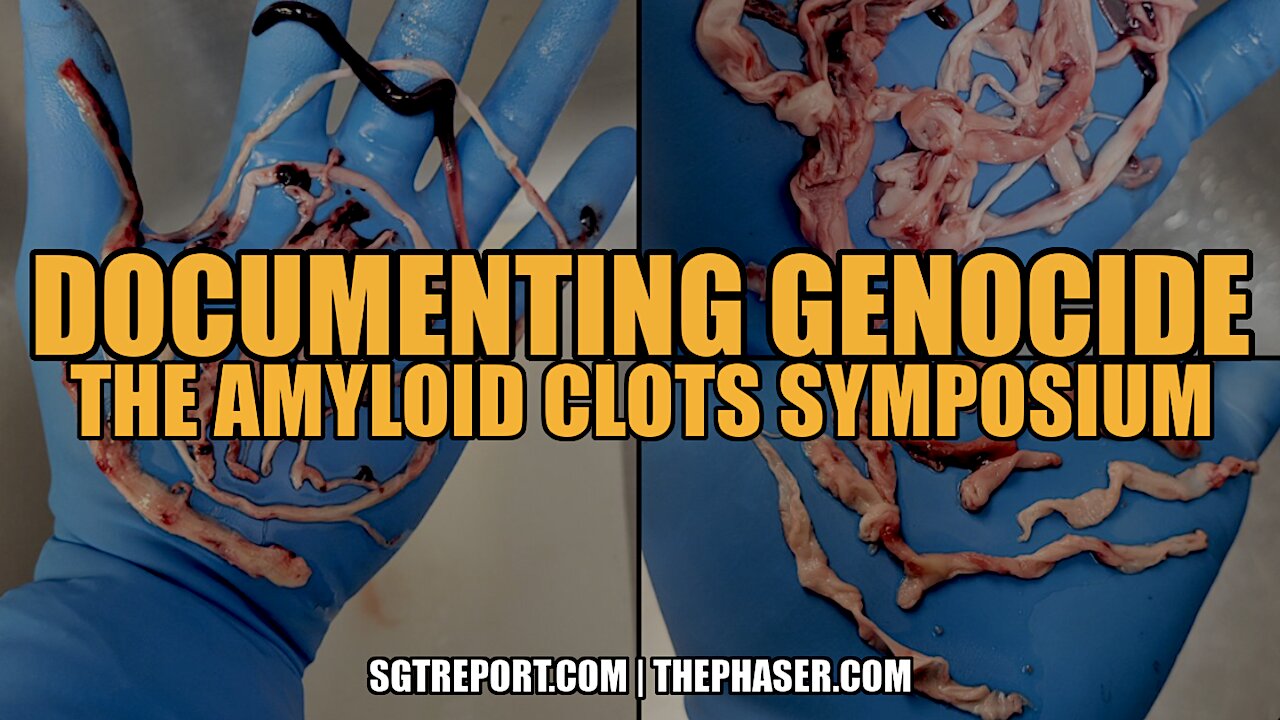 DOCUMENTING GENOCIDE: THE VAX AMYLOID CLOTS SYMPOSIUM