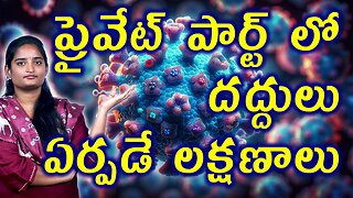 ప్రైవేట్ పార్ట్ లో దద్దుల లక్షణాలు Signs & Symptoms Of Genital Herpes | Herpes Infection Homeopathy