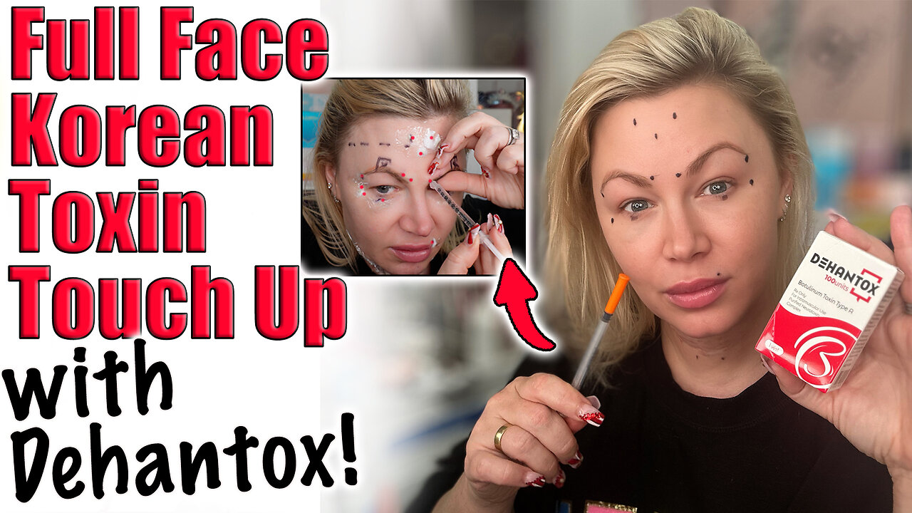 Full Face Toxin Touch Up w/ Dehantox ! AceCosm.com and code Jessica10 Saves you money
