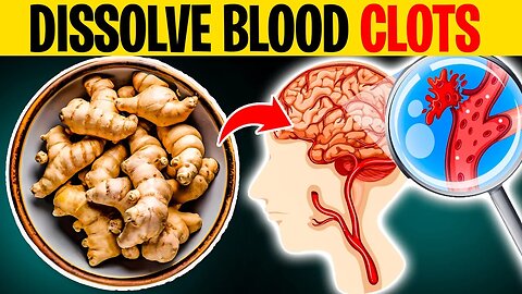 7 Natural Methods to Dissolve Blood Clots