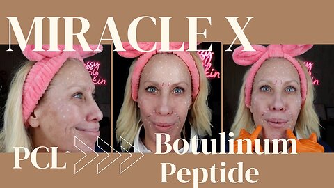 Miracle X - Why it's more than just PCL