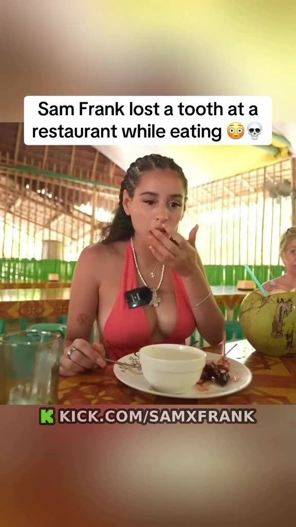 Sam Frank Loses a Tooth While Eating