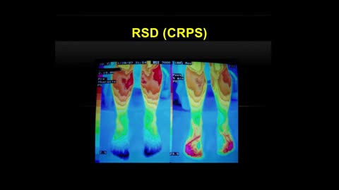 Advances in Integrative Medicine panel - Len Saputo