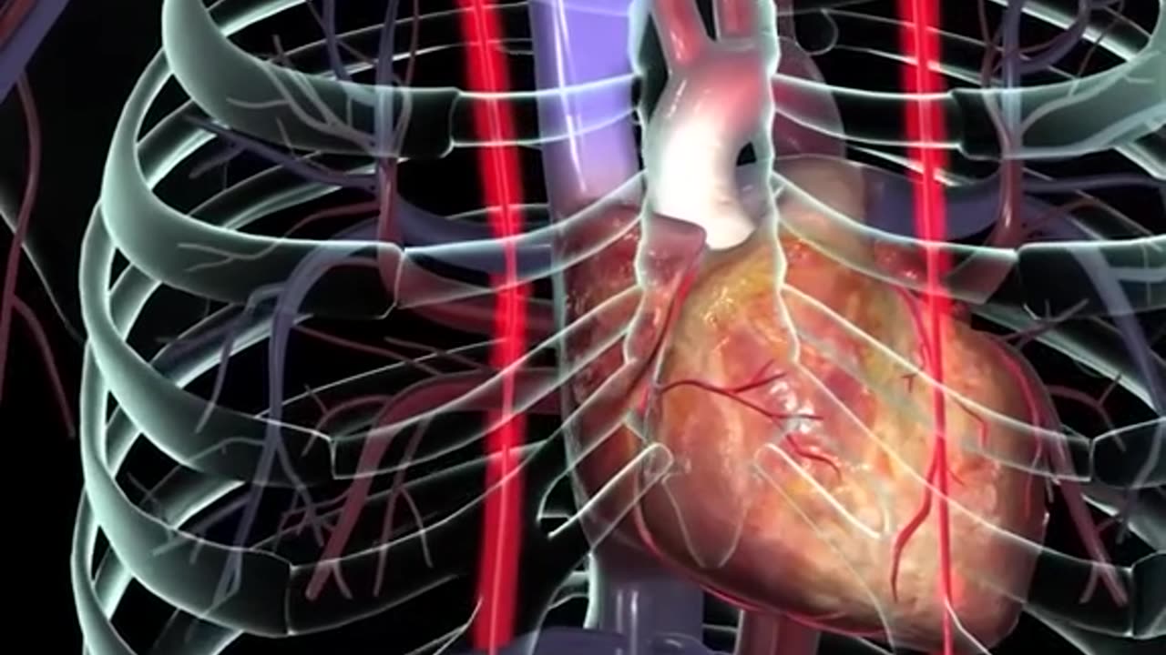 Heart Bypass Surgery 3D Animation (CABG)