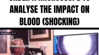 Dr. Ryan Cole Examines 4 Vaccine Samples Under the Microscope to Analyze Impact on Blood