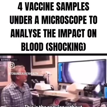 Dr. Ryan Cole Examines 4 Vaccine Samples Under the Microscope to Analyze Impact on Blood
