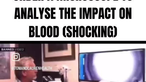 Dr. Ryan Cole Examines 4 Vaccine Samples Under the Microscope to Analyze Impact on Blood