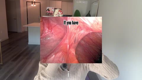 How Aligners Help Remove Facial Adhesions