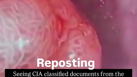 Wait what, Parasites cause Tumorous Cancers ⁉️