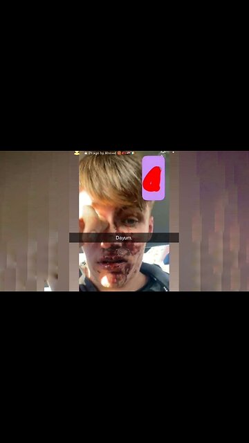 Blacks attack Irish child