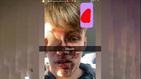 Blacks attack Irish child