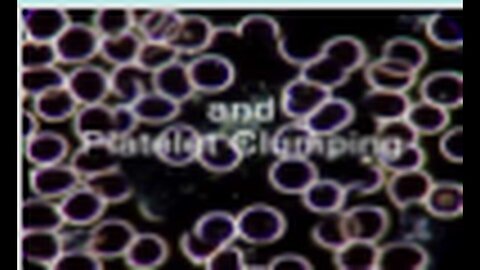 "Explaining 'Live Blood Analysis' and 'Dark Field Microscopy'"