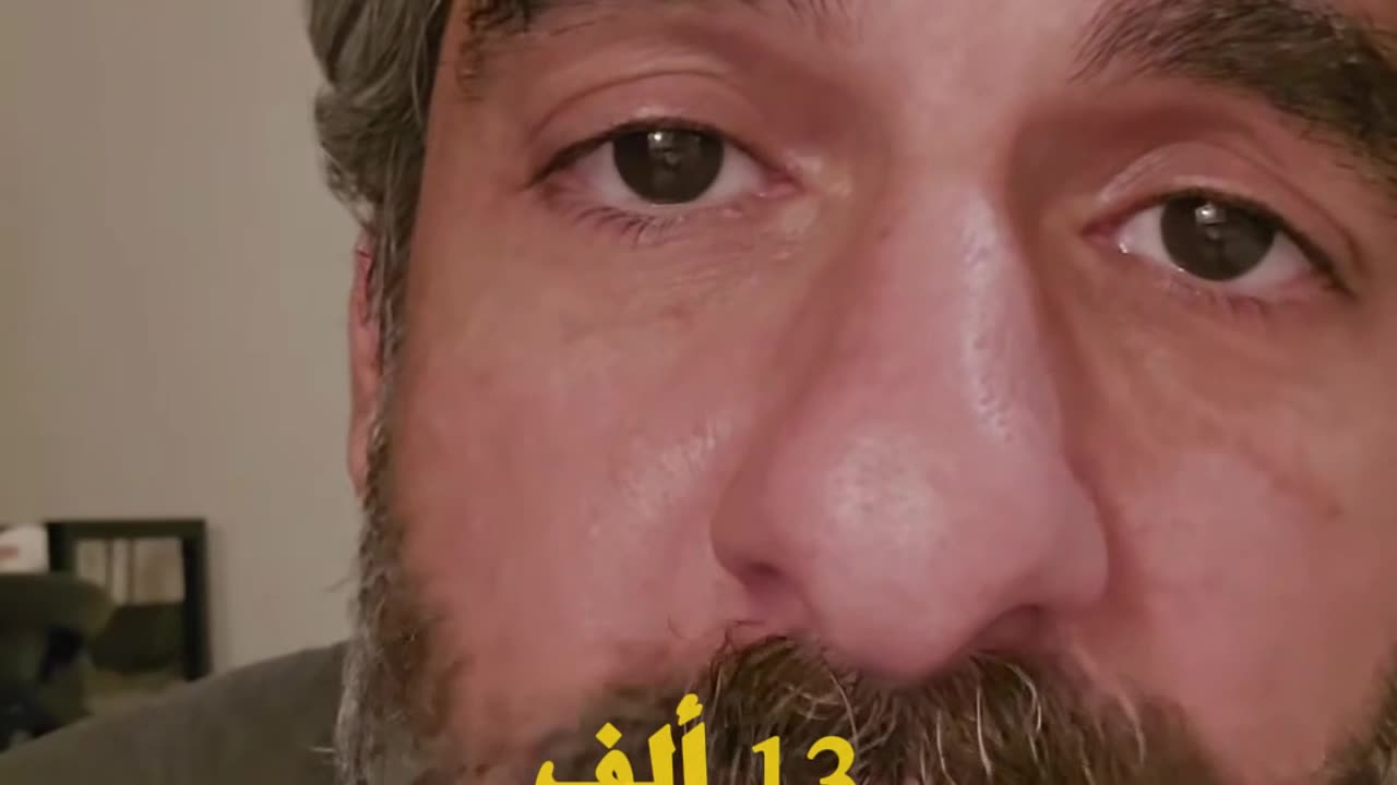متلازمة السبلايز